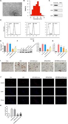 Therapeutic Potential of Exosomes Derived From circRNA_0002113 Lacking Mesenchymal Stem Cells in Myocardial Infarction